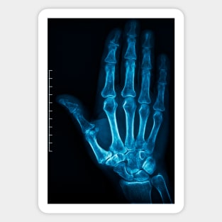 X-Ray Hand Sticker